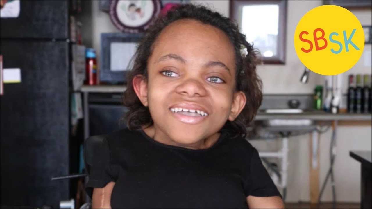 Adopted by Parents with the Same Diagnosis (Brittle Bone Disease)