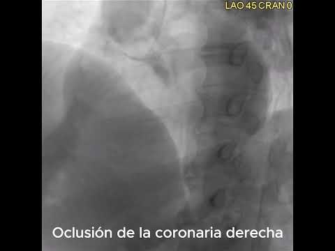 Oscar Arturo Lozano Cruz-5
