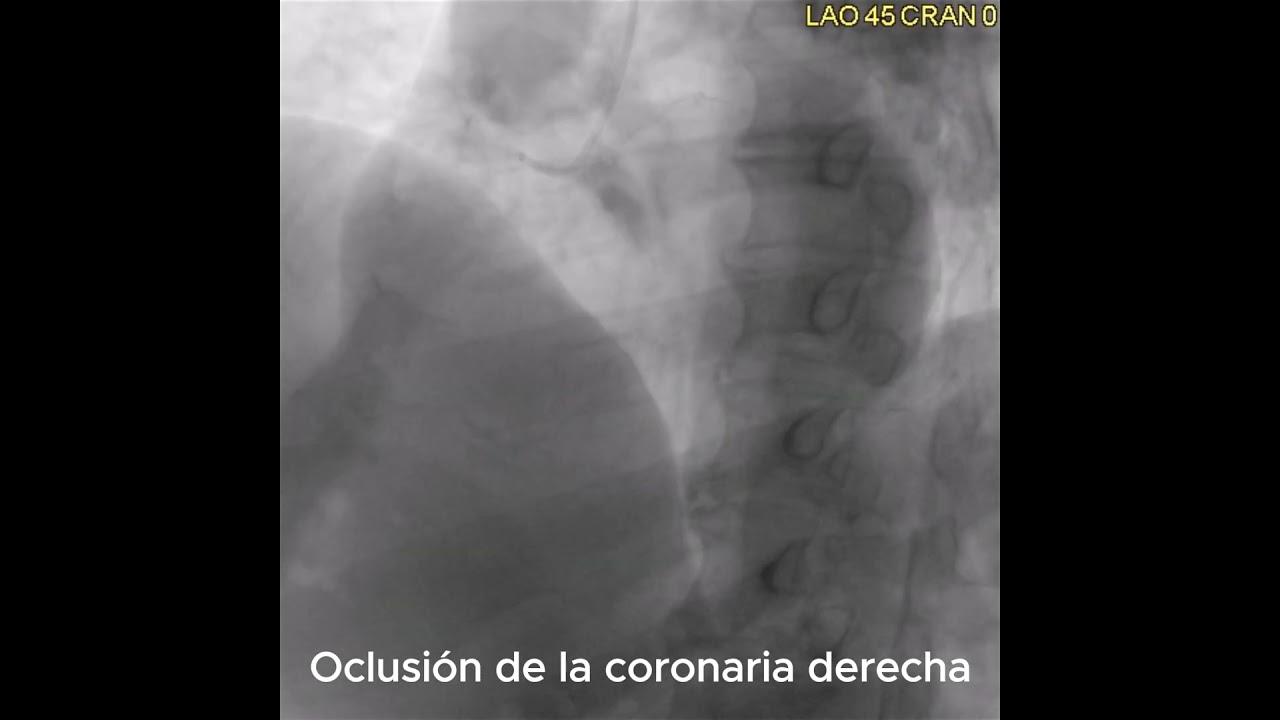 Oscar Arturo Lozano Cruz-1