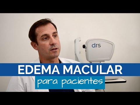 Qué es el Edema Macular | Síntomas y Tratamientos