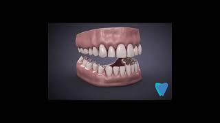 Clínica Odontológica en Coyoacán | Dent24 Expertos Dentales - Laura Karla Becerra Gamiño