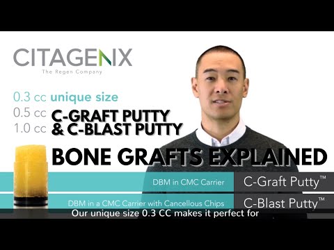 Bone Grafts For Dental Implants [C-Graft Putty & C-Blast Putty Explained] | Citagenix