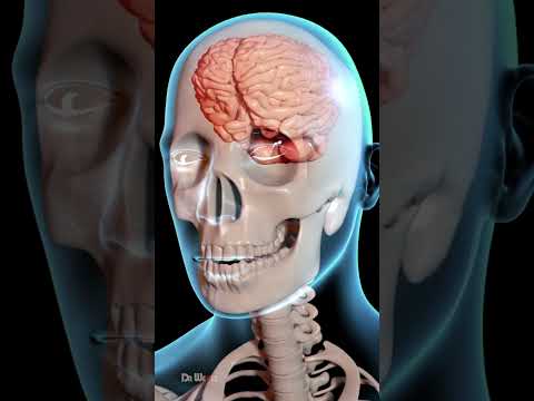 How Does a Concussion Affect Your Brain