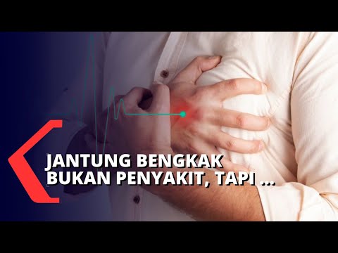 Jantung Bengkak atau Kardiomegali Patut Diwaspadai!