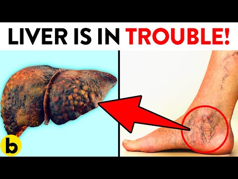 9 Ways Your Feet Are Telling You That Your Liver Is In Trouble