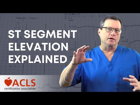 ST Segment Elevation Explained | ACLS Certification Association