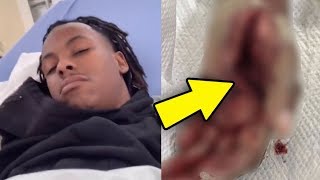 Rich The Kid Hospitalized and Almost Dies In ATV Bike Accident