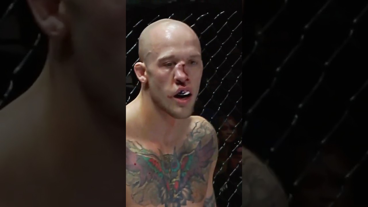 Blake Perry | Broken Nose | A1 Combat 4