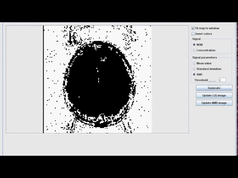 Application to parametric imaging of DCE-MRI perfusion tissue examinations