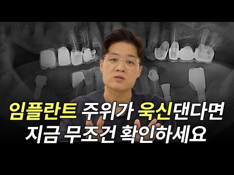 임플란트 주위염 증상·원인·치료법 완전 정복