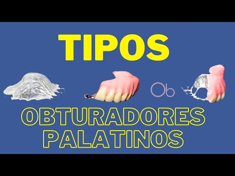 Tipos de Obturadores Palatinos