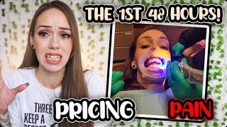 Invisalign Vlog! Everything You Need To Know B4 You Get It!