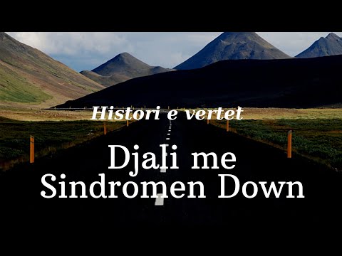 Djali me Sindromen Down/Histori e vertet...Duhet ta degjoni