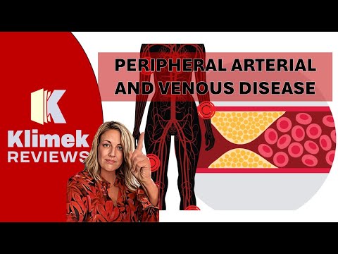 NCLEX-VORBEREITUNG: Arterien- und Venenerkrankungen