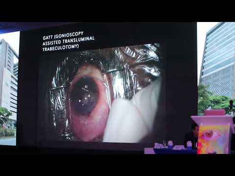 Dr. Luis Silva – To MIGS or not migs