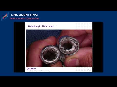 Using Aortic Endografts For Treatment of Aortoiliac Occlusive Disease