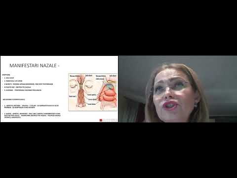 Manifestari ORL in pandemia SARS Cov 2