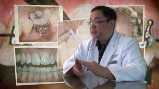 Basic Module 10 - Band and Bracket Placement