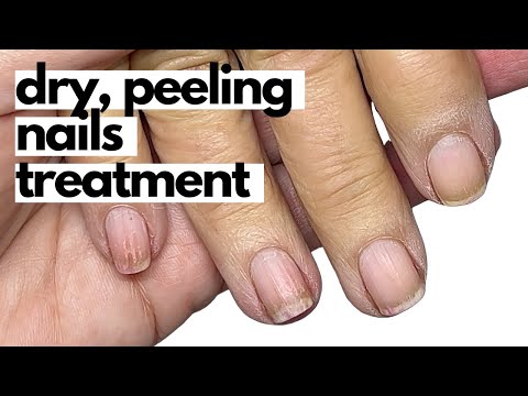 How to effectively condition dry, brittle nails! Start TODAY!!
