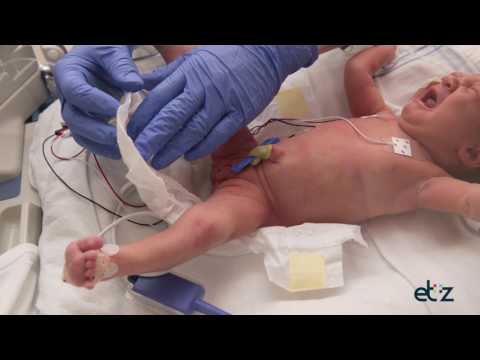 The 5 moments of hand hygiene