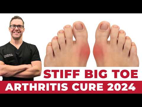 TOP 13 Ways to Shrink Bunions Naturally 1 HUGE SECRET