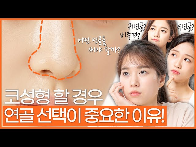 코성형과 얼굴형 잘하는 정우성형외과_코재수술ㅣ코재건_자가늑연골 코재수술 코성형과 얼굴형 잘하는 정우성형외과_코재수술ㅣ코재건_자가늑연골 코재수술