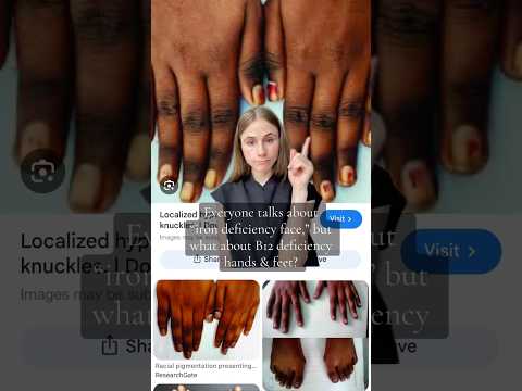 Vitamin B12 Deficiency Warning Sign #dermatologist