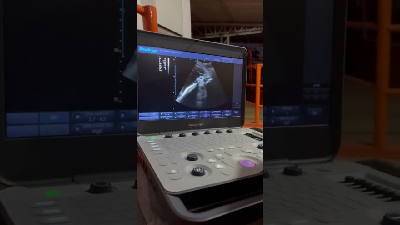 Monitoramento Gestacional
