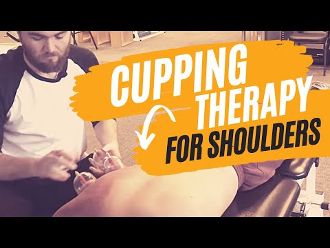 Cupping Therapy Techniques for the Shoulder