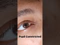 Pupil Constricted light response 😲😲😲 #mbbs  #trending #ytshorts