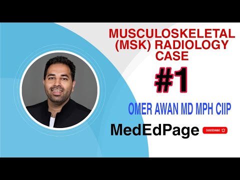 Musculoskeletal (MSK) Radiology Case #1