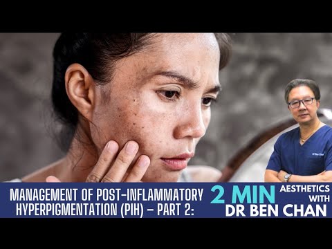 Post inflammatory hyperpigmentation part 2