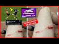 Aymeric Laporte Horror Thigh Injury vs Southampton | Armstrong Stud up Tackle on Laporte 😡