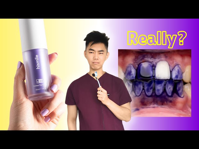 • جيل تبييض وتنظيف الاسنان السحري