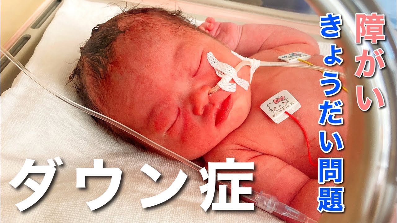 ダウン症の娘が生まれて思うこと