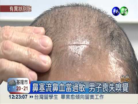 流鼻血竟罹癌! 男失嗅覺險失明