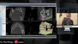Xelis Dental Paso a Paso Parte 1: Herramientas básicas y Report