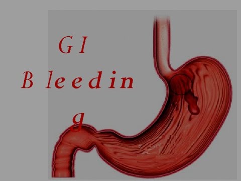 GI Bleed (Upper GIT Bleeding) Part 1 - YouTube