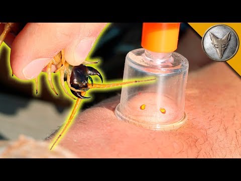 VENOM EXTRACTION - Centipede Bite Aftermath!