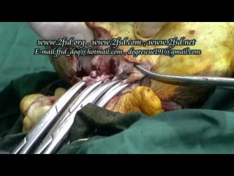 Ekaterinburg เพิ่มขึ้นหน้าอก ว่าหลังจาก angioplasty นมแม่