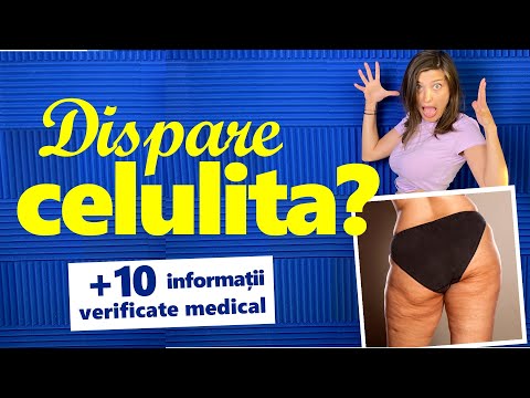 când pierdeți în greutate celulita dispare
