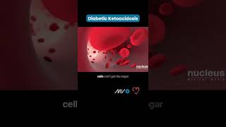 Download lagu 🚨 Understanding Diabetic Ketoacidosis (DKA) 🚨 mp3 Download lagu 🚨 Understanding Diabetic Ketoacidosis (DKA) 🚨 mp3