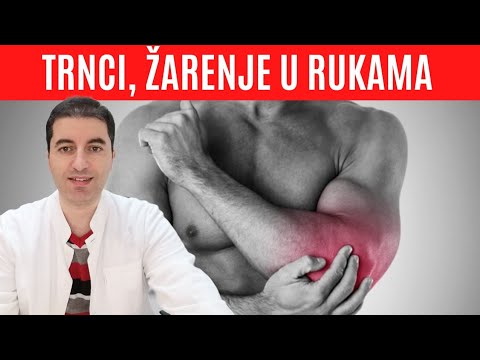 TRNCI, ŽARENJE, SIJEVAJUĆA BOL u rukama - kako je trajno izliječiti?