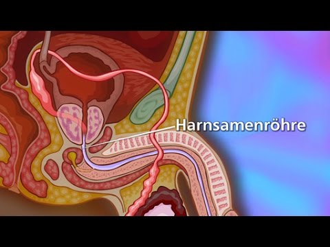 Entzündungshemmendes Mittel für Prostata Wie mit der Prostata essen
