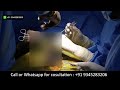 Tube Malleable Penile Implant Step By Step Penile Implant With ZSR Stapler Circumcision
