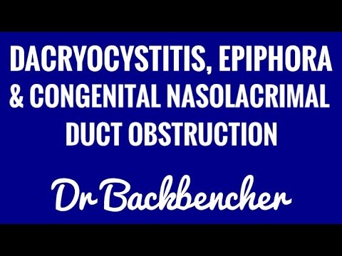 Dacryocystitis, Epiphora and Congenital Nasolacrimal Duct Obstruction