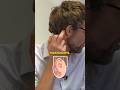 What Happens When Ear Infections Reach Your Skull?