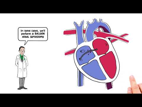 What is Transposition of the Great Arteries?