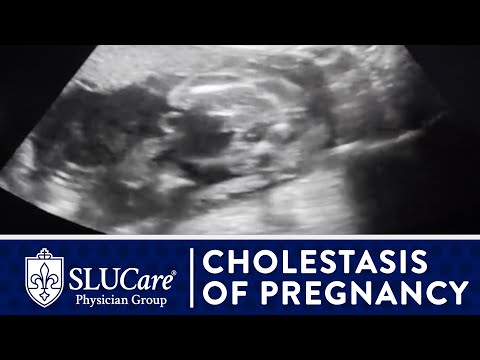 Cholestasis of Pregnancy: Treating Itchy Hands & Preventing Still Birth - SLUCare OB/GYN