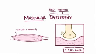 X-linked muscular dystrophy; Duchenne and Becker muscular dystrophy